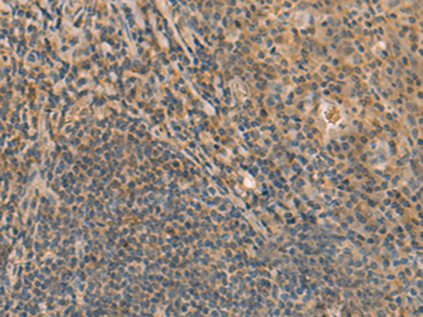 Rabbit Polyclonal Antibody to FAM186B