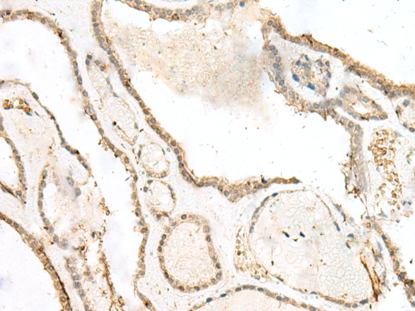 Rabbit Polyclonal Antibody to LIG4