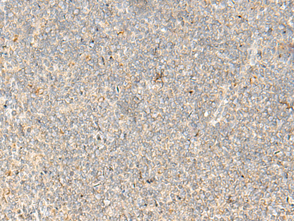 Rabbit Polyclonal Antibody to EIF3C