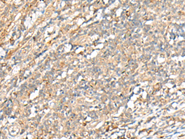 Rabbit Polyclonal Antibody to PCSK5