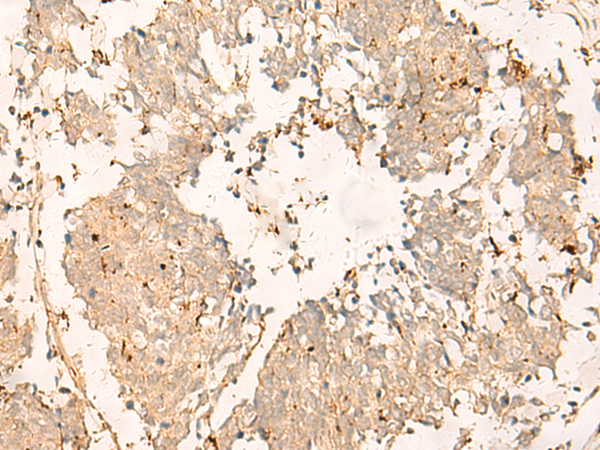 Rabbit Polyclonal Antibody to TEX11