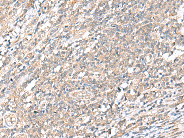Rabbit Polyclonal Antibody to WDR47