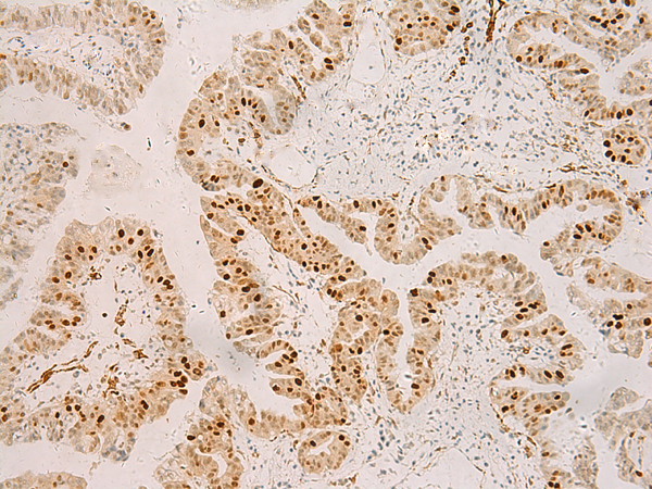 Rabbit Polyclonal Antibody to RFX6