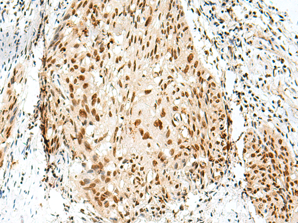 Rabbit Polyclonal Antibody to RBM10