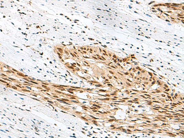 Rabbit Polyclonal Antibody to RBM12