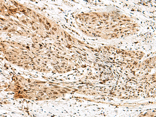 Rabbit Polyclonal Antibody to RBM15
