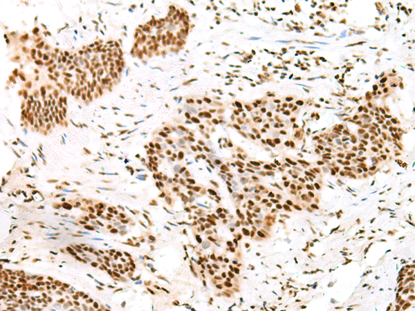 Rabbit Polyclonal Antibody to TCOF1