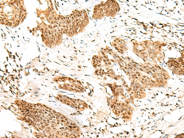 Rabbit Polyclonal Antibody to RBM19
