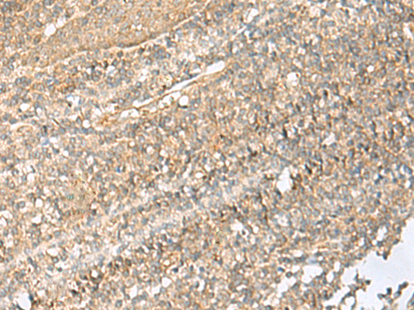 Rabbit Polyclonal Antibody to NID2