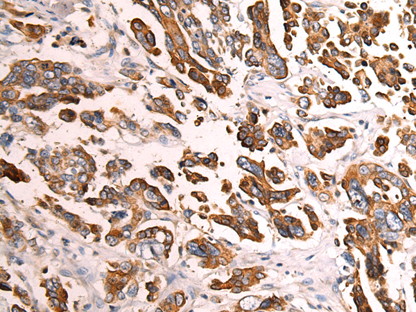 Rabbit Polyclonal Antibody to INPP4A