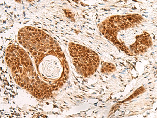Rabbit Polyclonal Antibody to POM121