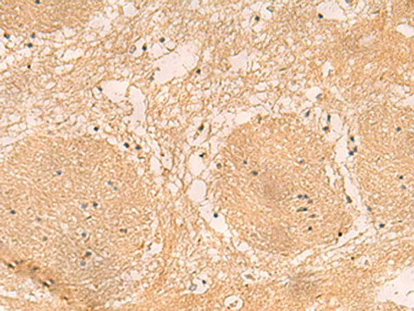 Rabbit Polyclonal Antibody to EMC1