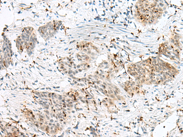 Rabbit Polyclonal Antibody to PLCL2