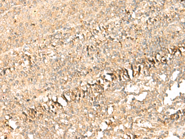 Rabbit Polyclonal Antibody to PSD4