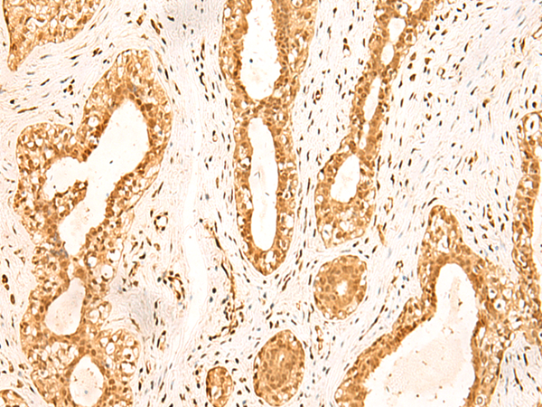 Rabbit Polyclonal Antibody to ZNF471