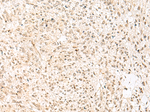 Rabbit Polyclonal Antibody to RBX1