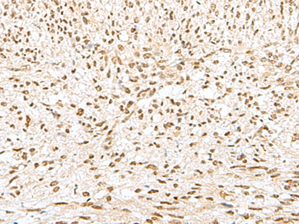 Rabbit Polyclonal Antibody to GTF2A2