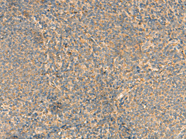 Rabbit Polyclonal Antibody to RPL34