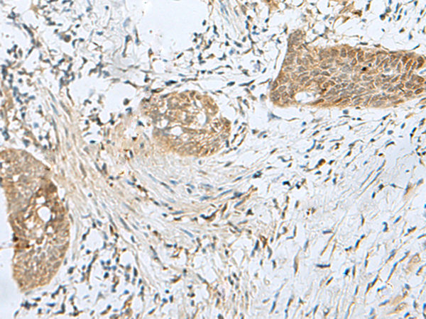 Rabbit Polyclonal Antibody to SNRPD1