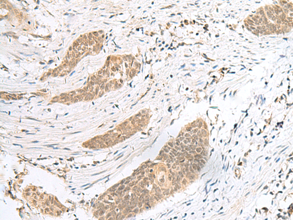 Rabbit Polyclonal Antibody to ENSA