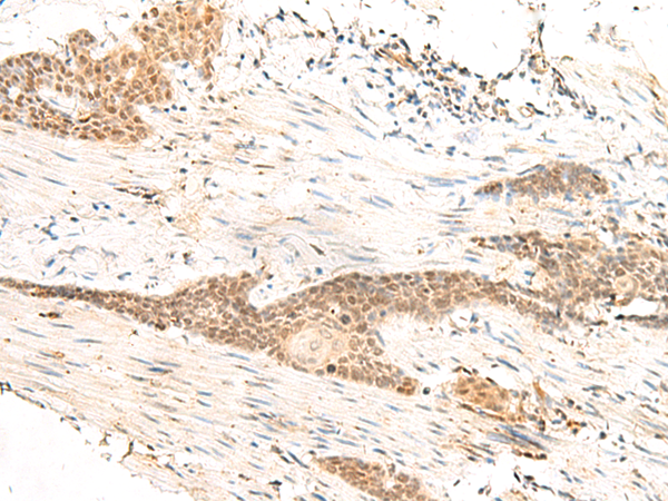 Rabbit Polyclonal Antibody to POLR1D