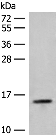 Rabbit Polyclonal Antibody to RPP14