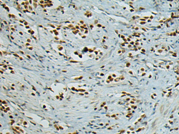 Rabbit Polyclonal Antibody to GLRX2