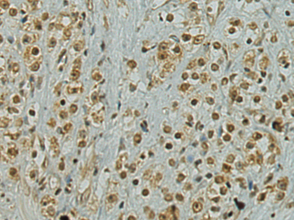 Rabbit Polyclonal Antibody to SUB1