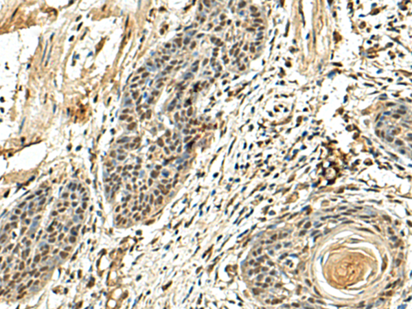 Rabbit Polyclonal Antibody to NUTF2