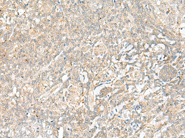 Rabbit Polyclonal Antibody to BEX2