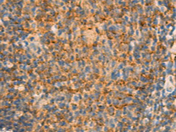 Rabbit Polyclonal Antibody to IFITM2