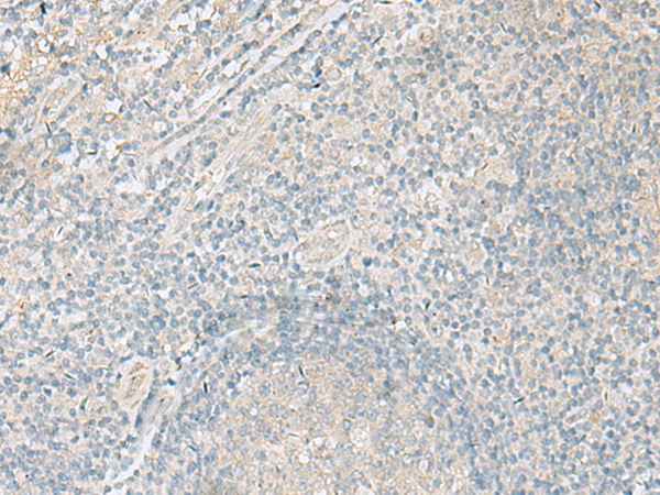 Rabbit Polyclonal Antibody to CPLX1
