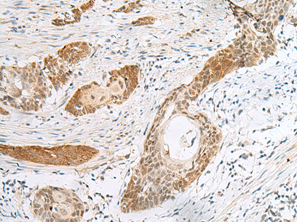 Rabbit Polyclonal Antibody to H2BC12