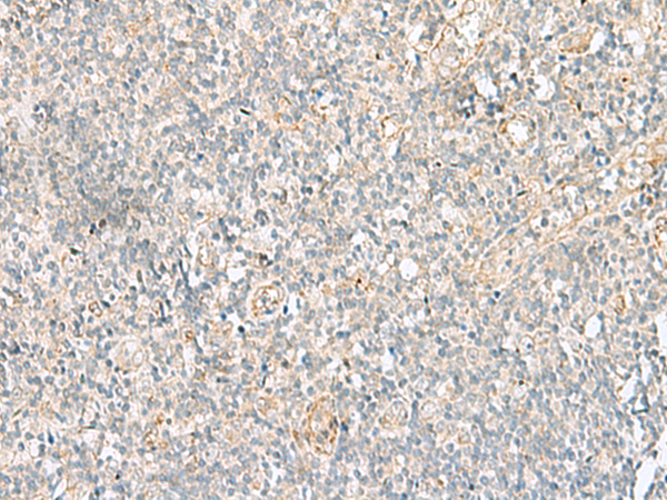Rabbit Polyclonal Antibody to GSKIP