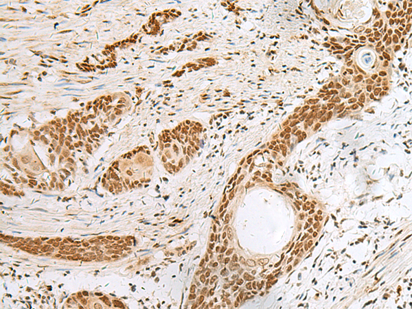 Rabbit Polyclonal Antibody to PNRC2