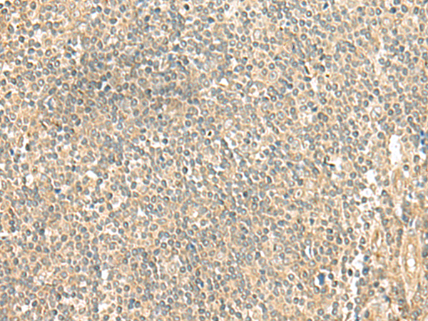 Rabbit Polyclonal Antibody to LMO3