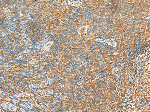 Rabbit Polyclonal Antibody to MTHFD2L