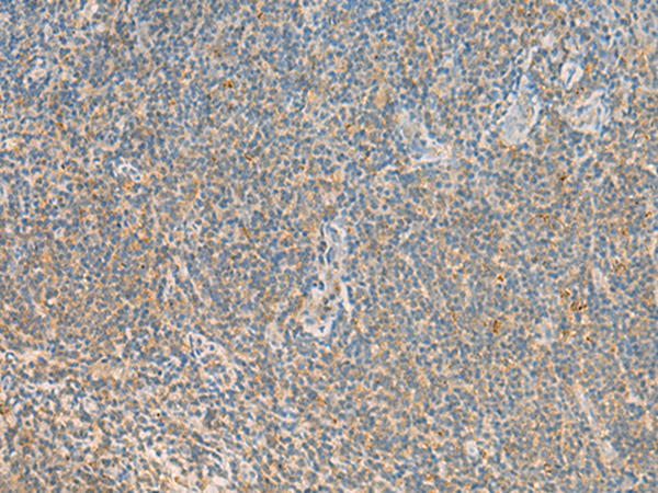 Rabbit Polyclonal Antibody to MPZL1