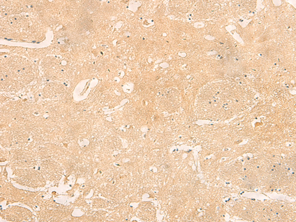 Rabbit Polyclonal Antibody to RNASE4