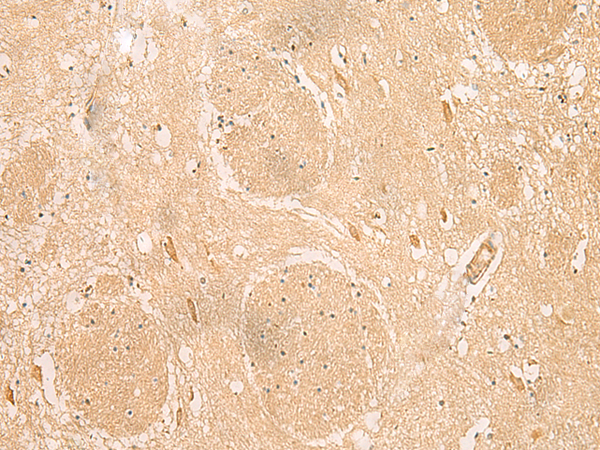 Rabbit Polyclonal Antibody to MGST3