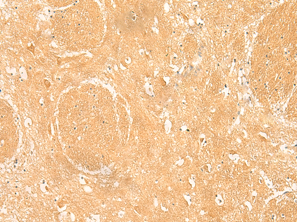 Rabbit Polyclonal Antibody to ARPC5L