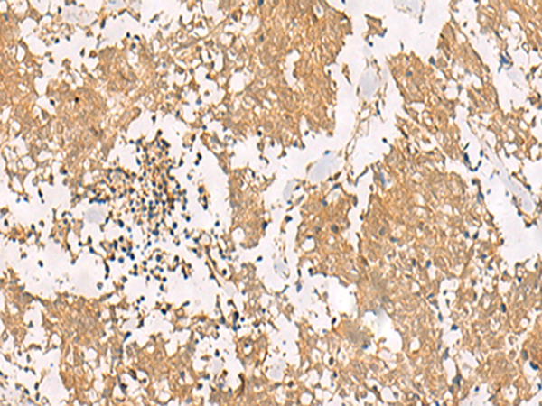Rabbit Polyclonal Antibody to PFDN2