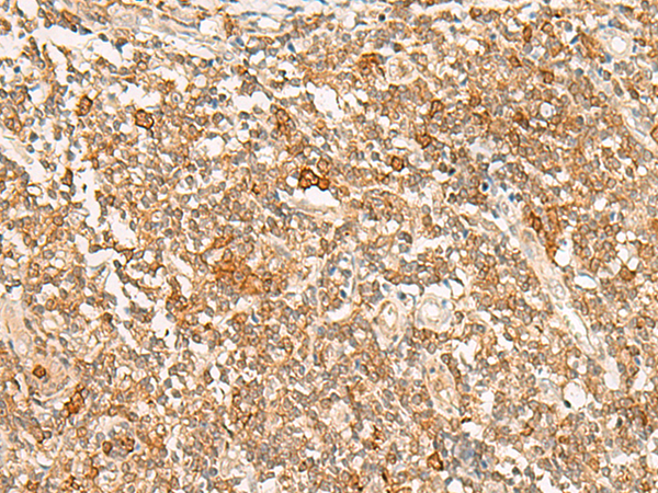Rabbit Polyclonal Antibody to JPT1