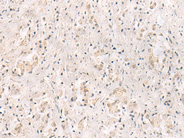 Rabbit Polyclonal Antibody to IL36RN