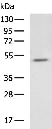 Rabbit Polyclonal Antibody to MKNK2