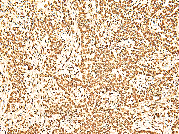 Rabbit Polyclonal Antibody to ILF3