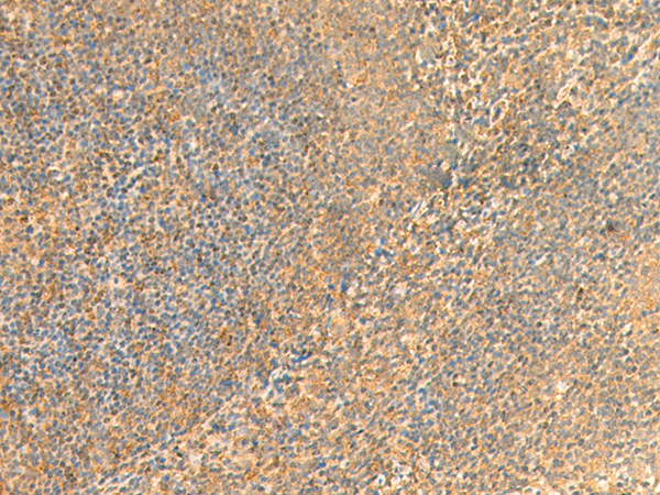 Rabbit Polyclonal Antibody to UBD