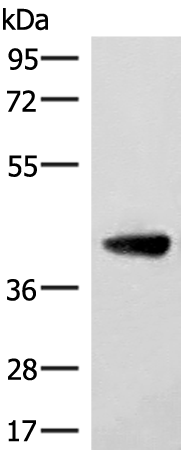 Rabbit Polyclonal Antibody to ST8SIA4