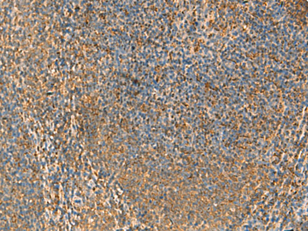 Rabbit Polyclonal Antibody to PPP1R1A