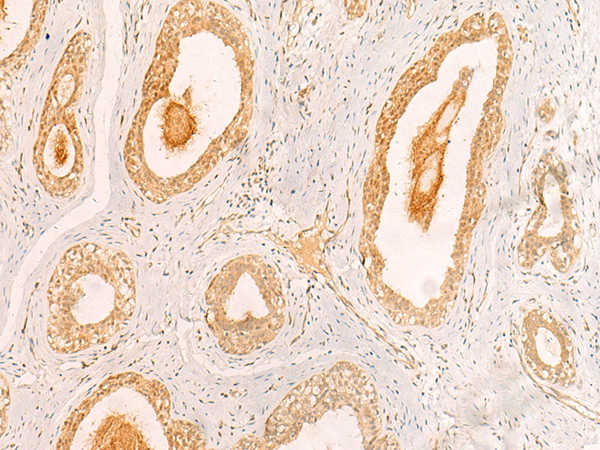 Rabbit Polyclonal Antibody to ZNF580
